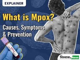 What is Mpox